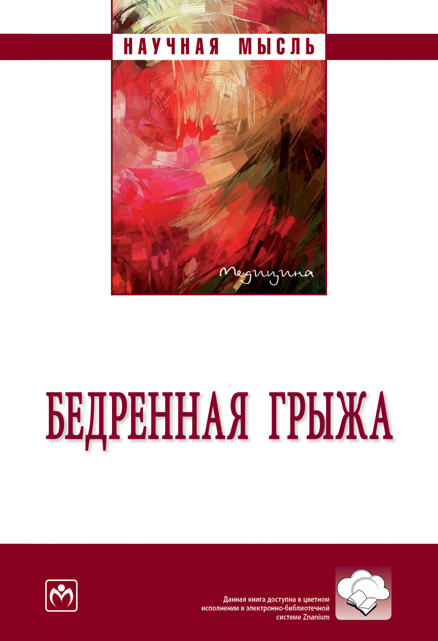 Бедренная грыжа
