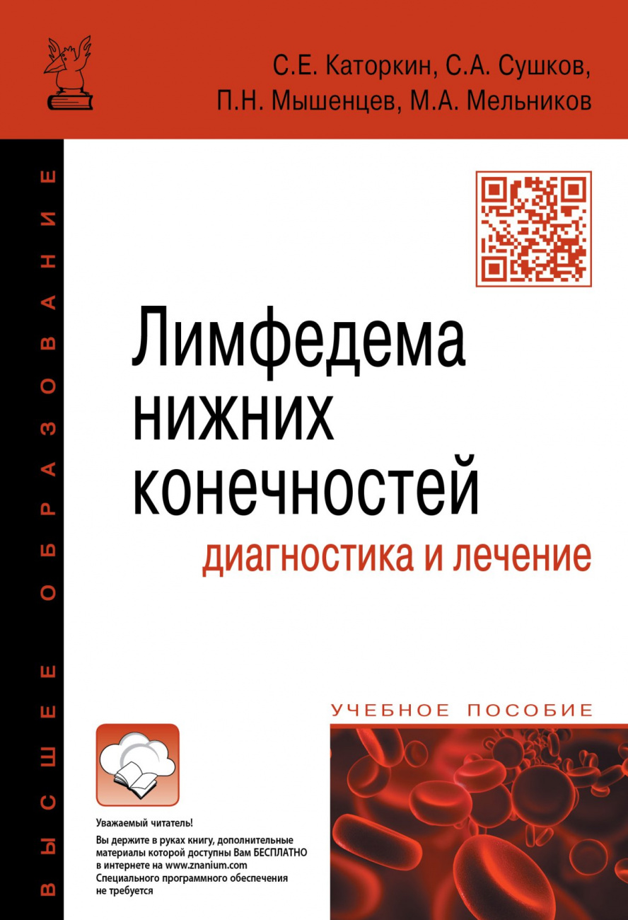 Лимфедема нижних конечностей: диагностика и лечение