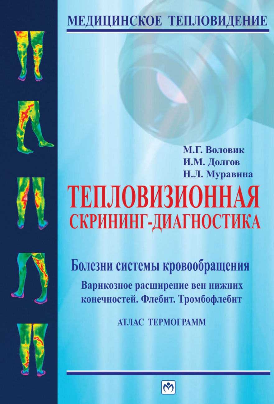 Тепловизионная скрининг-диагностика. Болезни системы кровообращения. Варикозное расширение вен нижних конечностей. Флебит. Тромбофлебит. Атлас термограмм