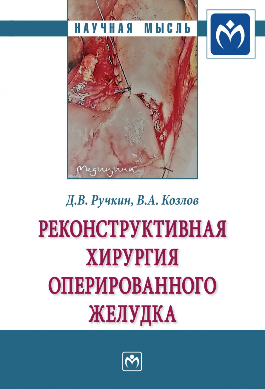 Реконструктивная хирургия оперированного желудка