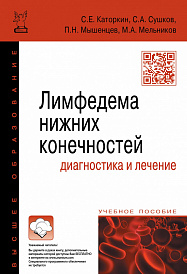 Лимфедема нижних конечностей: диагностика и лечение